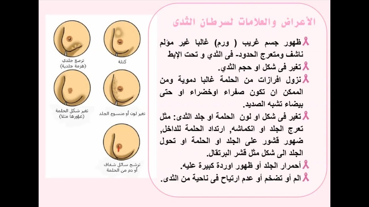 اهم الاسباب والعلاج للمرض الخبيث - مرض سرطان الثدي 3605