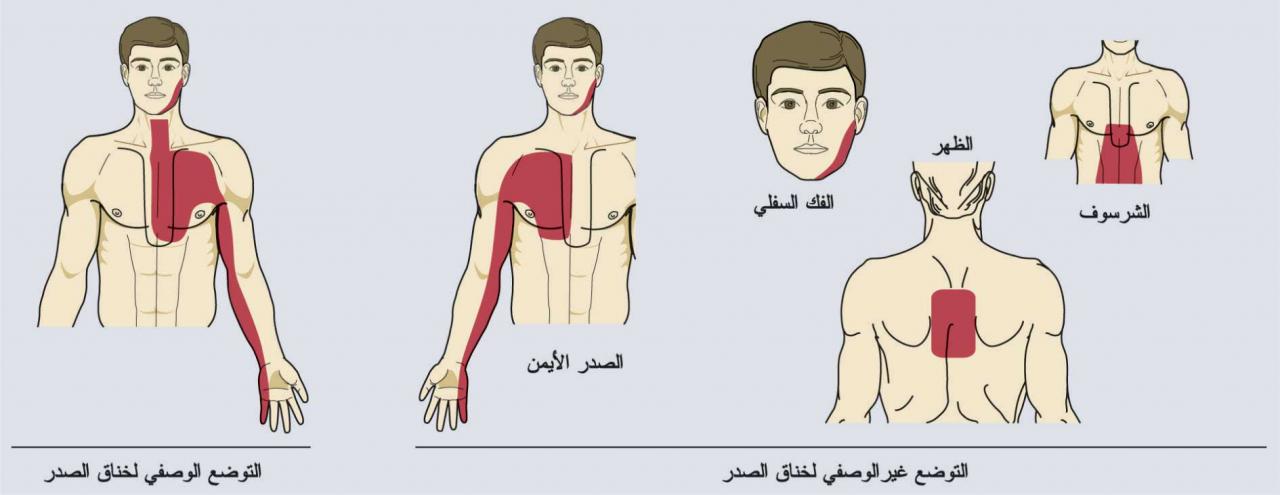 الم في الصدر الايسر - مخاوف الوجع ف الصدر الشمال