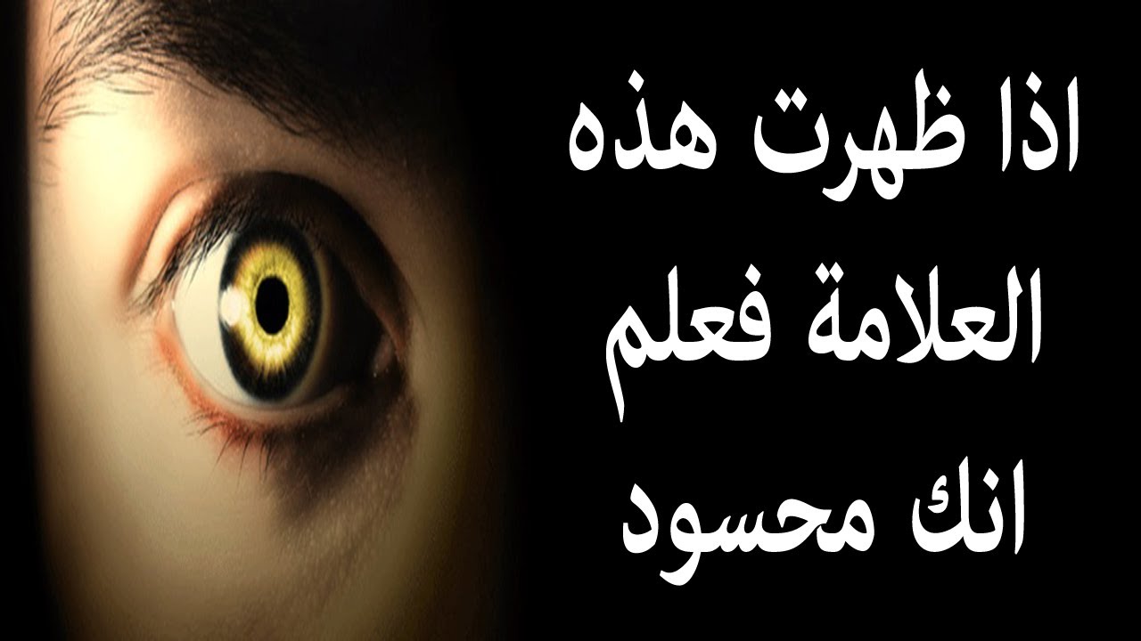 الكثير من العلامات اللي متعرفوش عنها حاجه - علامات الحسد 3485 4