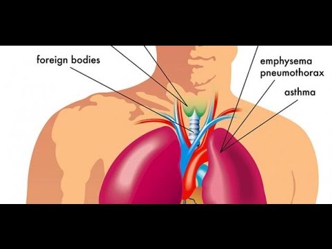 اسباب ضيق التنفس - هل هو عرض ام مرض- 5755 2