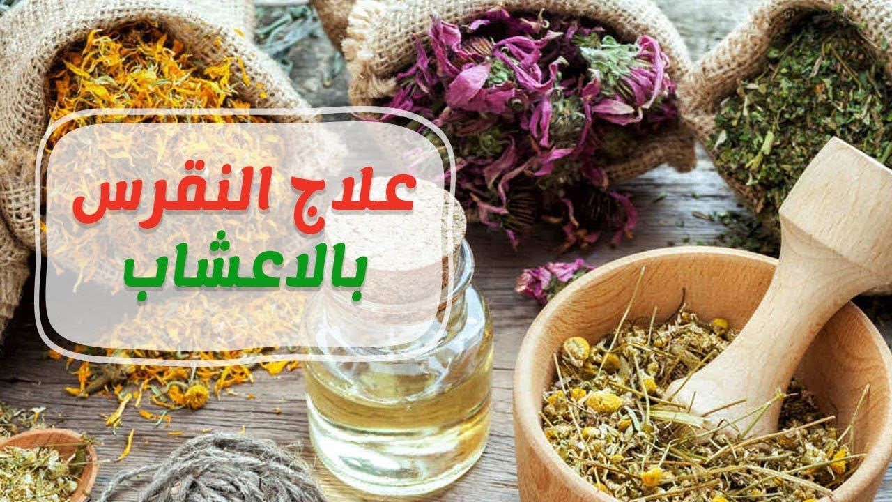 علاج النقرس بالاعشاب , اعشاب في كل بيت