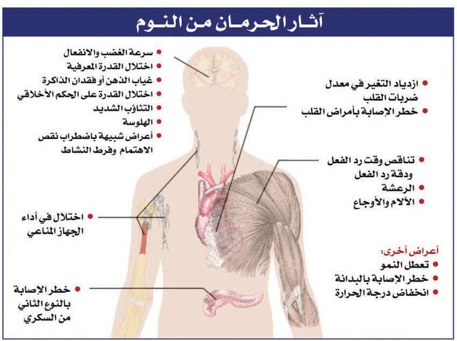 ماذا يسبب قلة النوم - خطوره كبرى من نتيجه قله النوم 10617 3