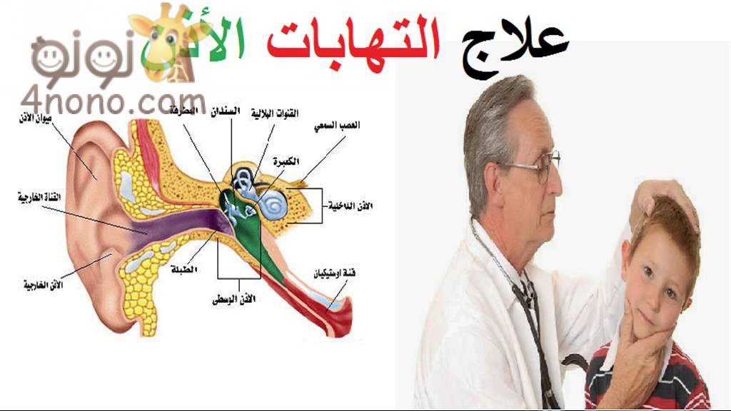 علاج التهاب الاذن - ما هو العلاج المناسب لالتهاب الاذن 2131 2