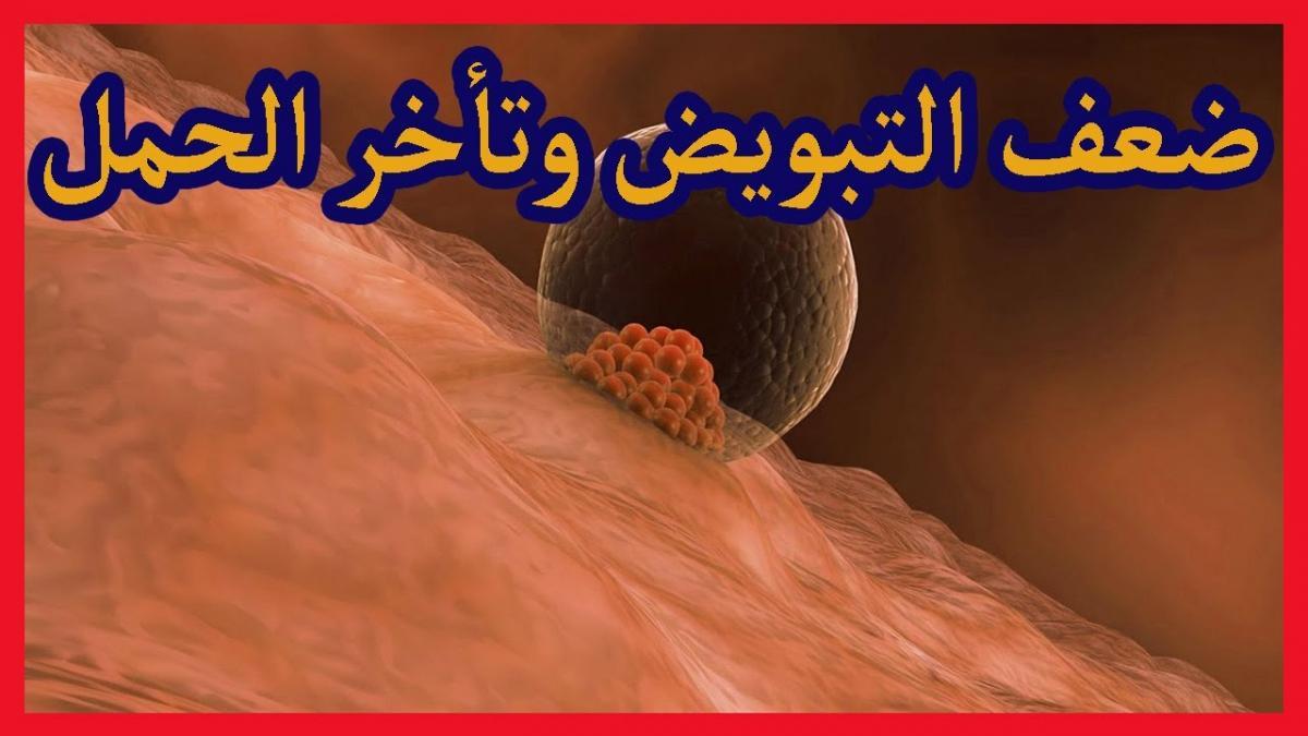 علاج ضعف المبايض 3492 8