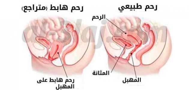 كيف اعرف ان الرحم نظيف بعد الاجهاض - معلومات طبيه مهمه جدا للمراه 10483