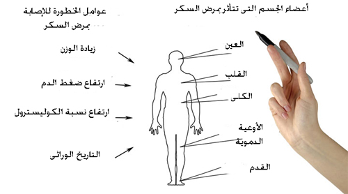 اضرار مرض السكر - اضرار ارتفاع السكر 1466 2