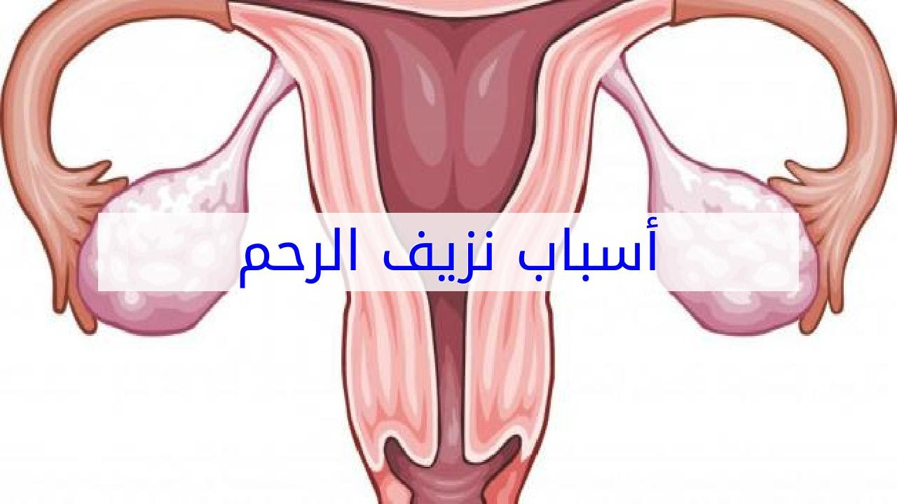 اسباب نزيف الرحم - هذه اهم اسباب نزيف الرحم التي يجب معرفتها 10840 2