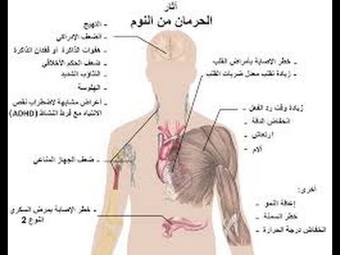 علاج الارق - كيف اتخلص من الارق 5011 1