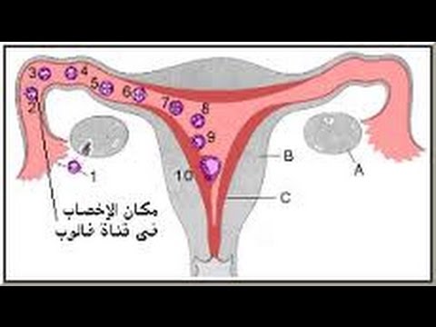 عند تلقيح البويضة ماذا تشعر المراة - ماذا يحدث للمراة عند تلقيح البويضة 2011