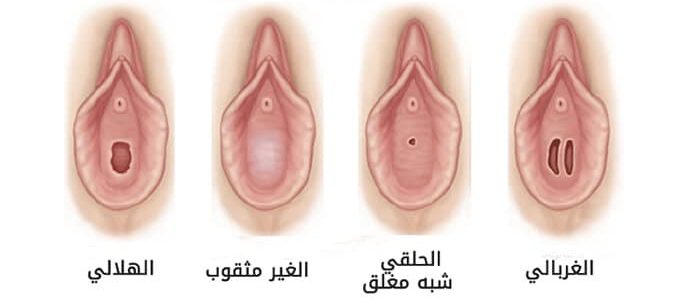 كيف اعرف اني عذراء - كيف اعرف اني مازلت بكرا 6723