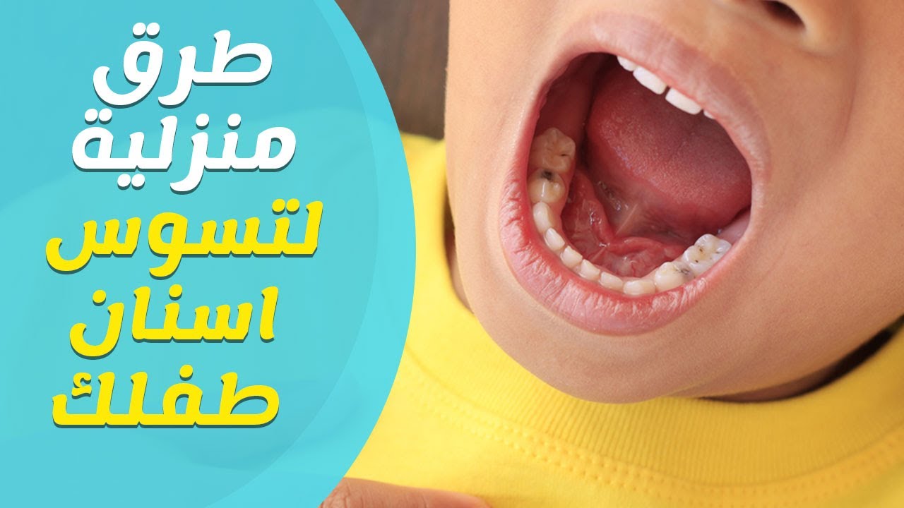 اسباب واعراض وعلاج التسوس - علاج تسوس الاسنان 5254 2