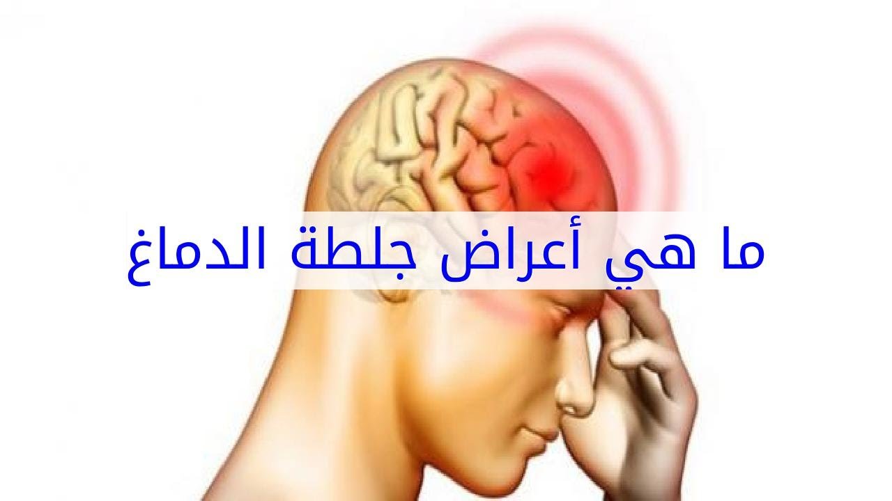 اعراض الجلطة - علامات تدل علي انك علي وشك الاصابة بجلطة 3068 1