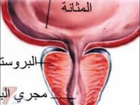 مرض البروستات - اعراض مرض البروستات عند الرجال 4722