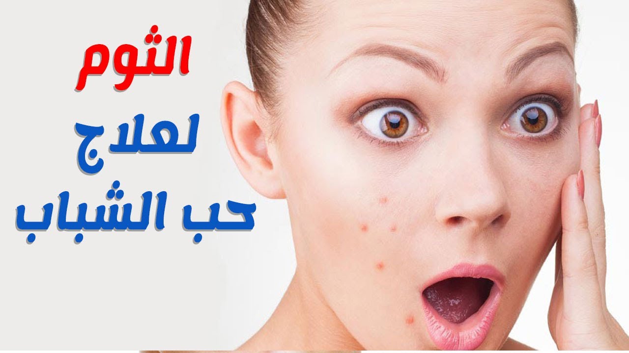 علاج حب الشباب بالثوم - تاثير الثوم في علاج حب الشباب 10738 2