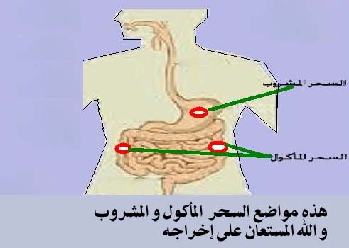 اعراض خروج السحر - ازاى تعرف ان السحر خرج من جسمك بالعلامات