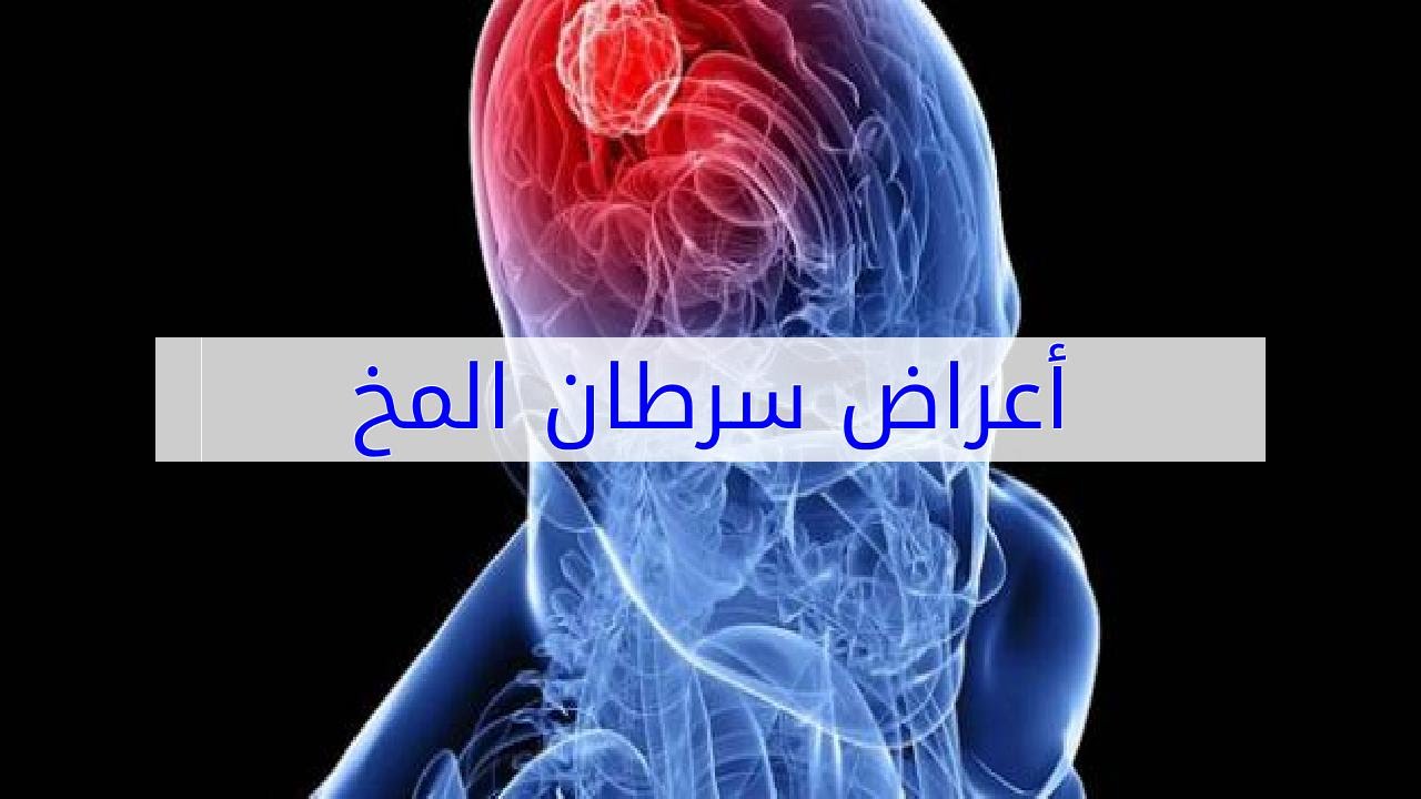 اغرب الاعراض اللي هتعرفوها لاول مره - اعراض سرطان الدماغ 3527