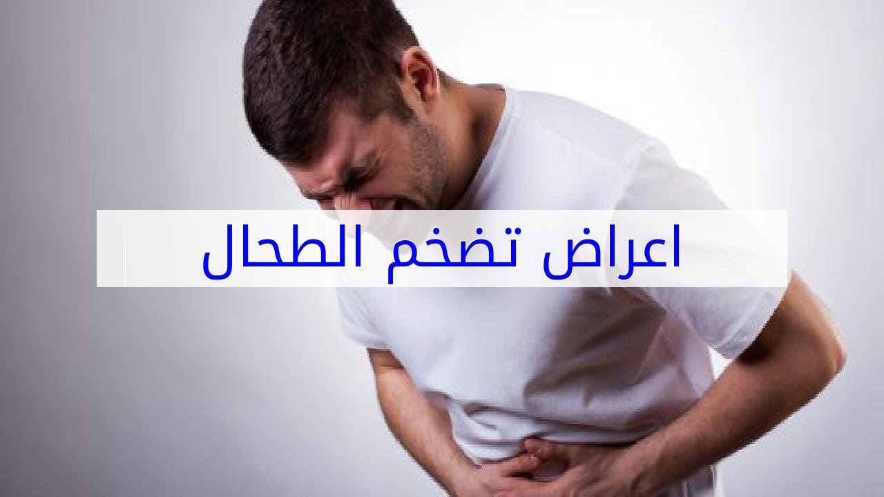 تضخم الطحال - علاج تضخم الطحال 4039 1