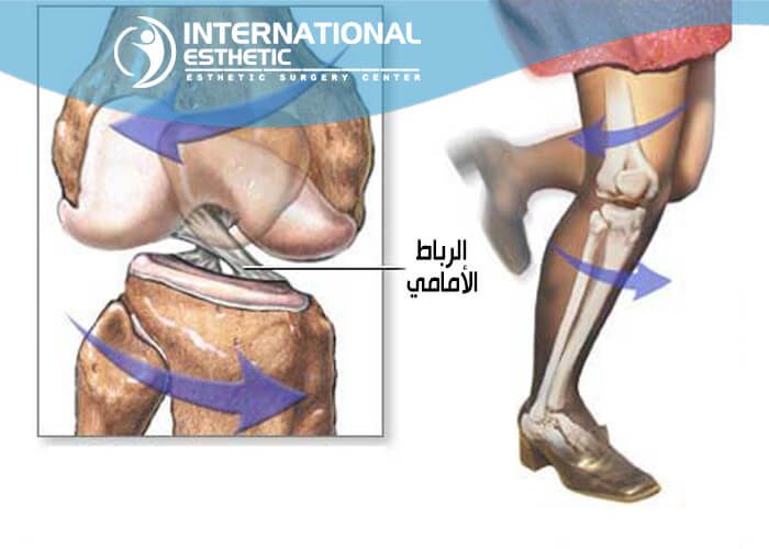 عملية الرباط الصليبي - تعرف على عملية الرباط الصليبي 2135 1