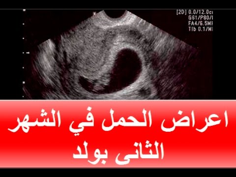 علامات الحمل بولد في الشهر الثاني 2501