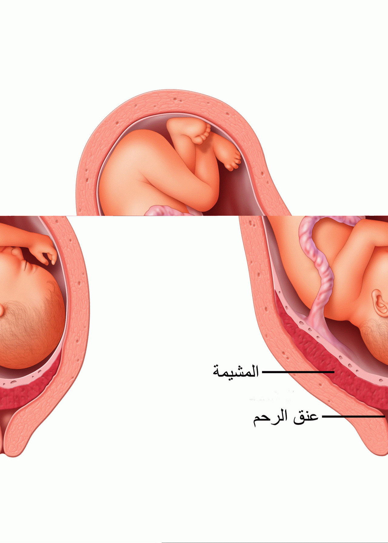 صور للولاده - لحظات جميله جدا بقدوم المولود الجديد 1211