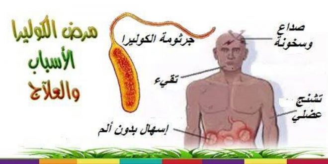 اعراض مرض الكوليرا - ما هو مرض الكوليرا 4336