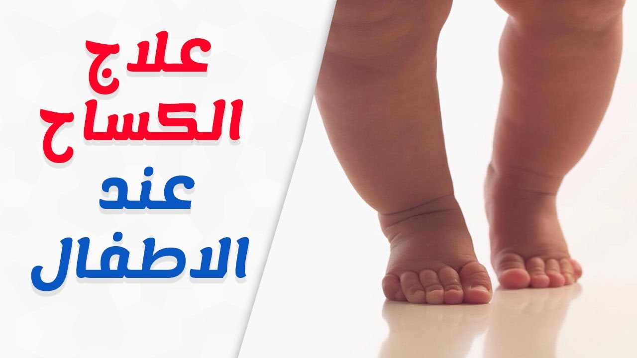 مرض الكساح - علاج مرض الكساح 2205