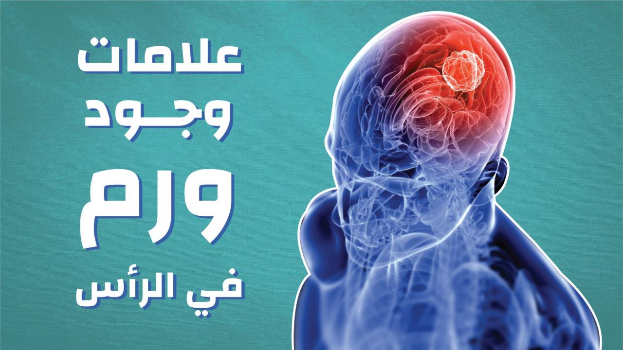 اغرب الاعراض اللي هتعرفوها لاول مره - اعراض سرطان الدماغ 3527 9