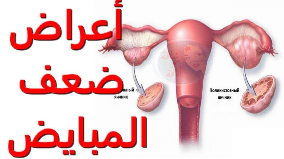 علاج ضعف المبايض 3492 2