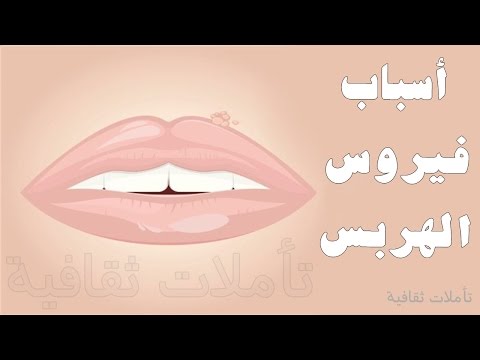 مرض الهربس - ما هو مرض الهربس و علاجه 0 34