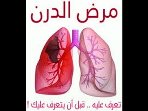 مرض الدرن , اعراض مرض الدرن