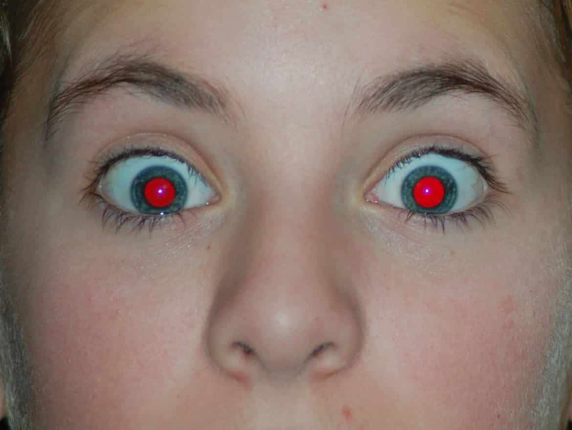 الاسباب التى تؤدي الي احمرار العين , العين الحمراء - كارز